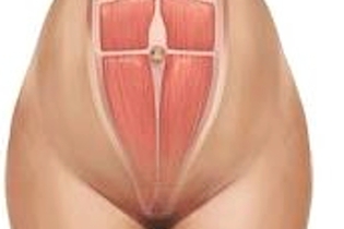 abdominoplastia e gestação 2